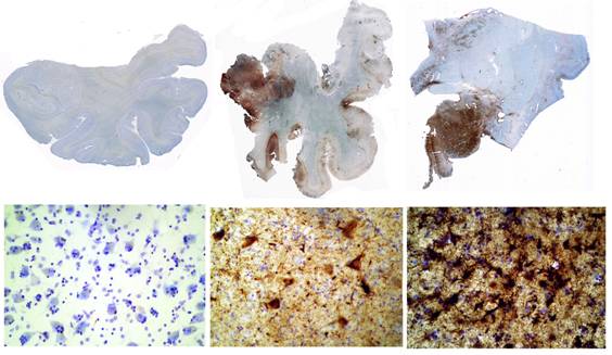 Tau immunostained sections of medial temporal lobe