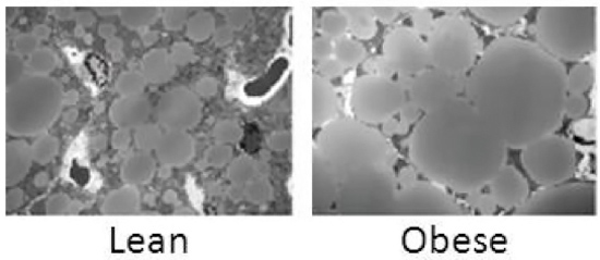 Brown Fat, mitochondria loss, brown fat whitening, obesity onset