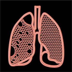 computer model of healthy lung tissue and tissue of a lung with emphysema