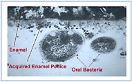 human acquired enamel pellicle