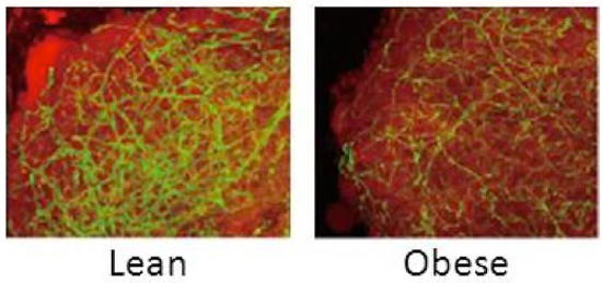 Brown Fat, blood vessels, obesity