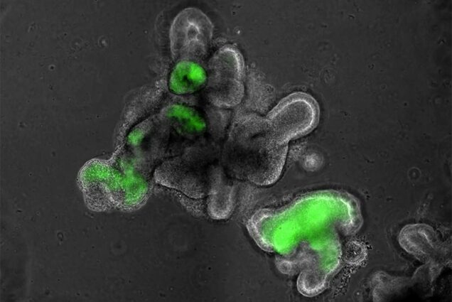 Microscopic image of human induced pluripotent stem cells (iPS cells) turning into lung cells