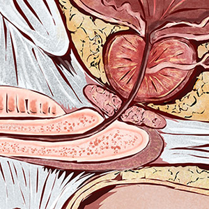 Illustration of a prostate gland