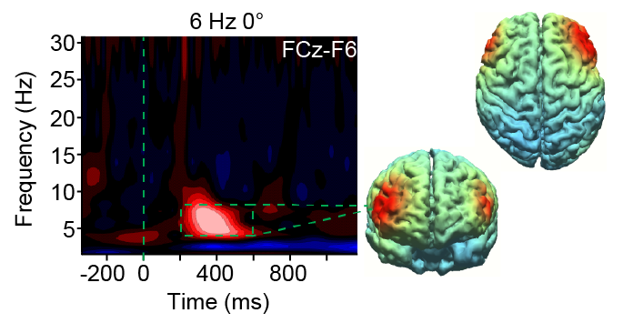 Brain study conducted by Reinhart