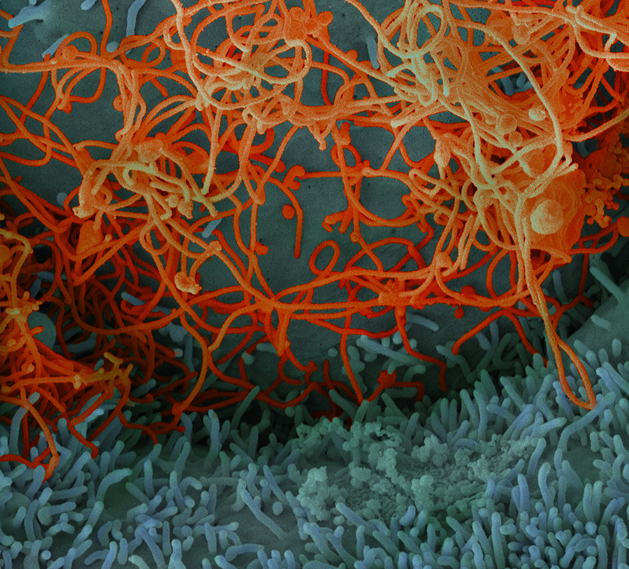 Ebola up close and personal