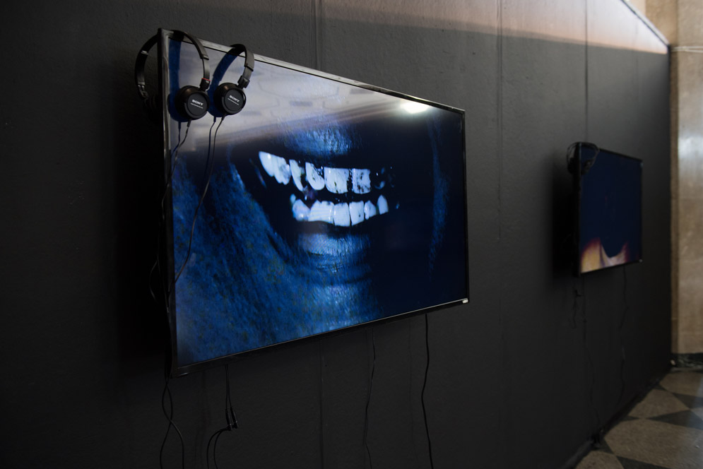 teeth displayed on a tv screen 