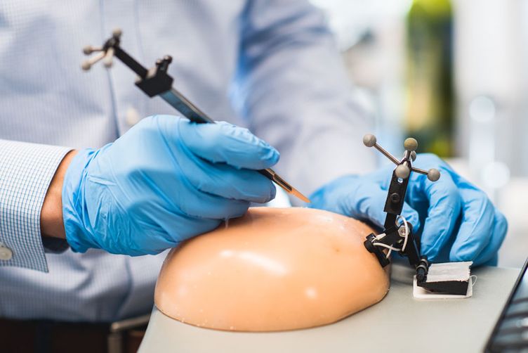 Ascalpel and sensor patch, part of the AcouStar lumpectomy guidance system, are shown about to make an incision on a silicone “phantom” breast.