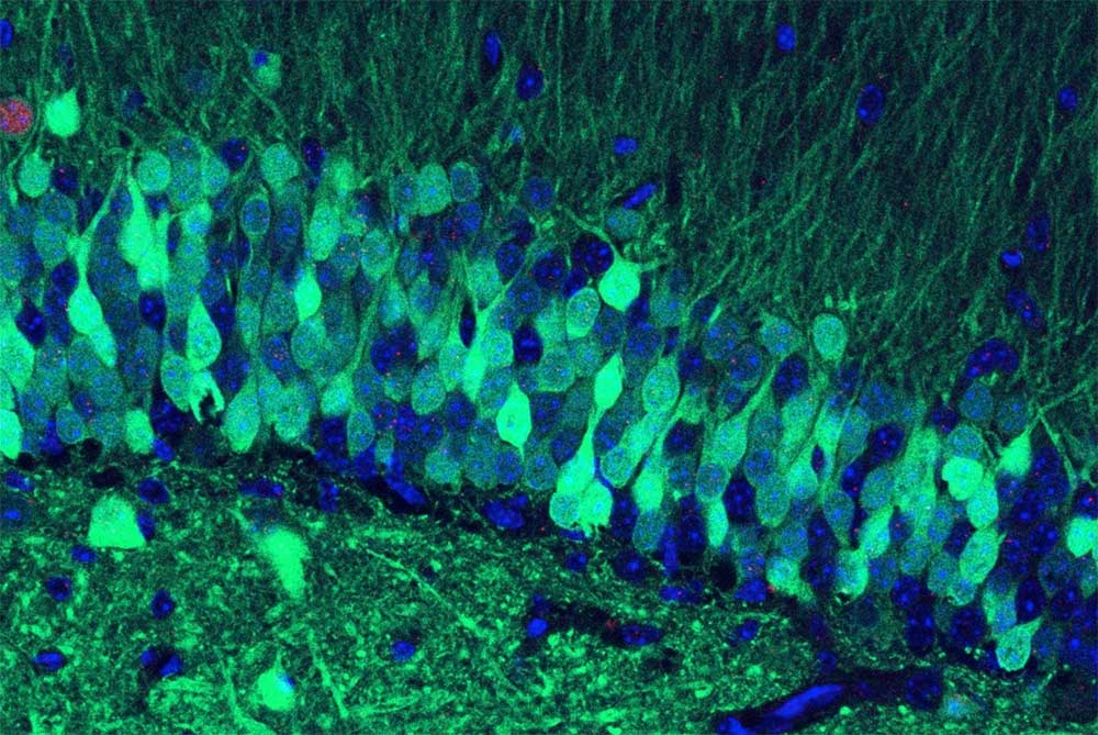 This is what a bad memory looks like in a mouse brain. The cells glowing green indicate that they are being activated in storing a fear memory. Credit: Ramirez Group at BU