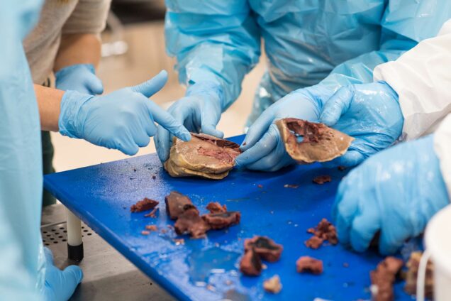 Teachers and graduate students in the Boston University Cadaver Lab advanced anatomy class point and discuss features of a dissected human heart