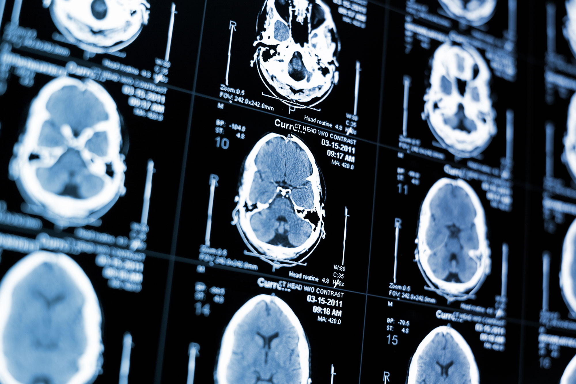 Setting The Record Straight: Is Addiction A Mental Illness Setting The Record Straight: Is Addiction A Mental Illness