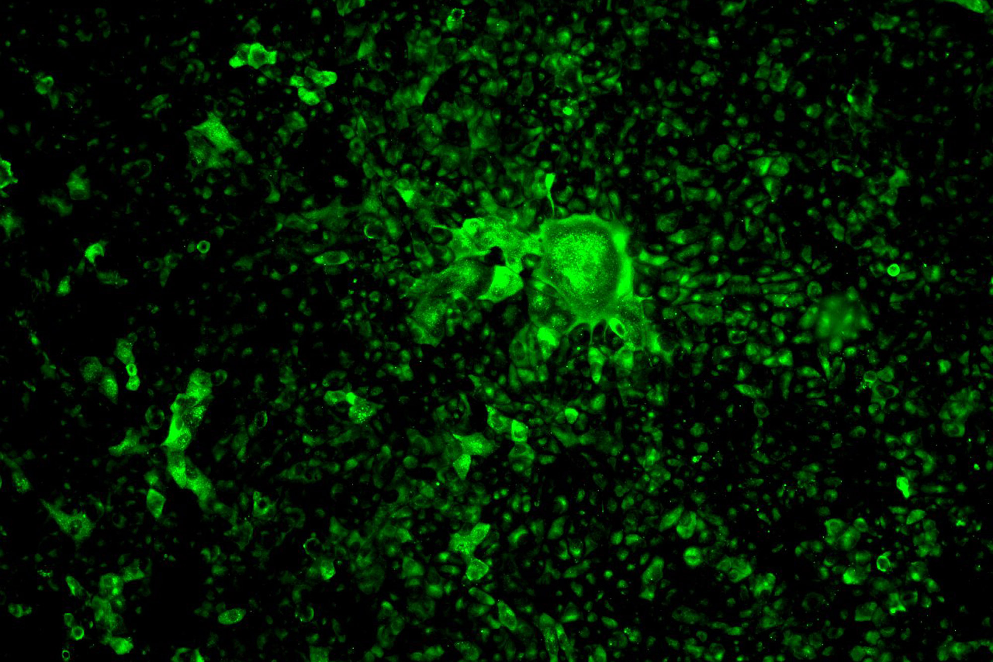 A photo of cells infected with the novel coronavirus glowing green under blue light