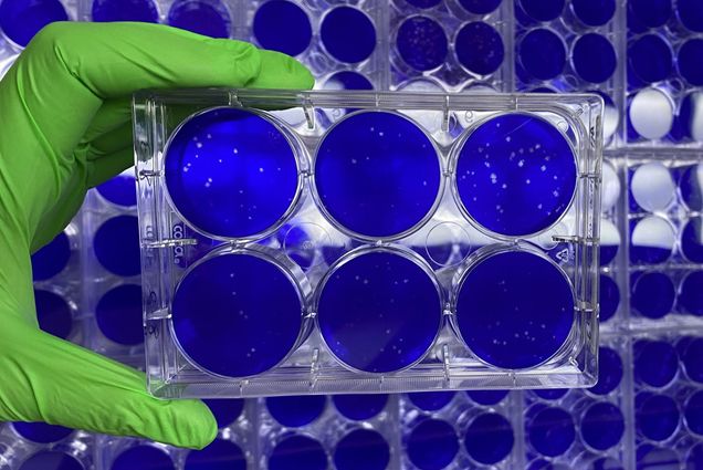 nanosponges containing fragments of lung cell membranes in a cell culture in a NEIDL laboratory