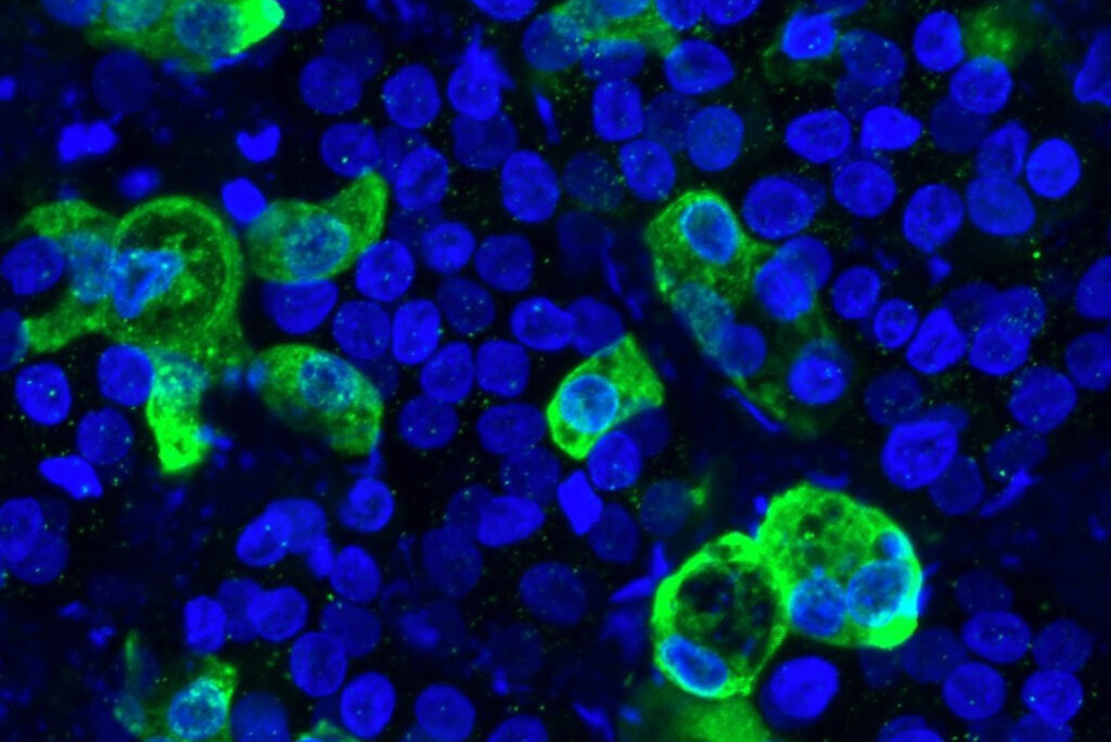 An image of bluestem-cell-derived lung cells