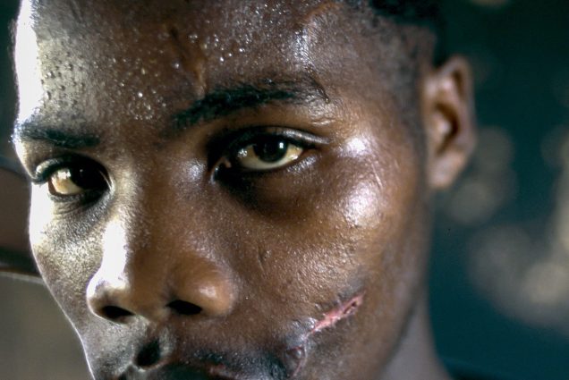 A 1996 portrait of an African National Congress supporter who was shot in the face and had his home burned the year before. 
