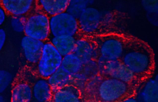 Microscopic image of human lung cells infected with COVID-19 coronavirus