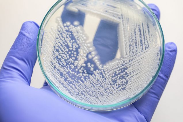 photo of a blue-gloved hand holding a clear petri dish of yeasts. The white yeast lie in criss-crossed pattern and the hand adds a contrast to make it clearer to see them.