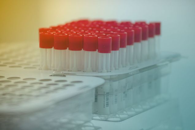 Detail photo of a tray of nasal swabs for COVID-19 testing in containers with red caps. The photo is tinted yellow and teal.