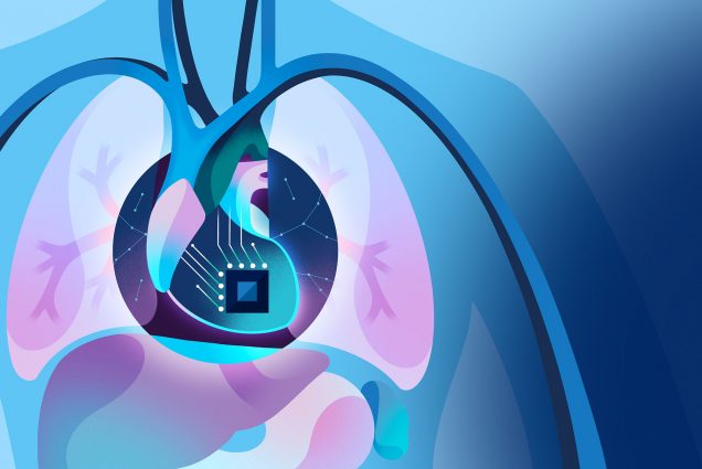Sci-fi looking illustration of a pair of lungs in a human body with a computer chip where the person's heart should be. The illustration is done in muted blue and purplish colors.