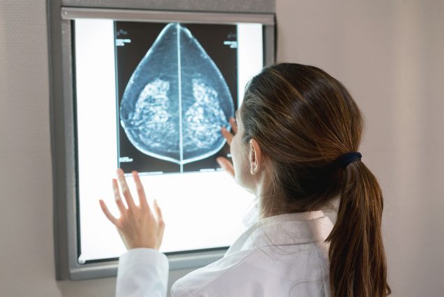 An oncologist reviews an x-ray image of a breast cancer patient's chest