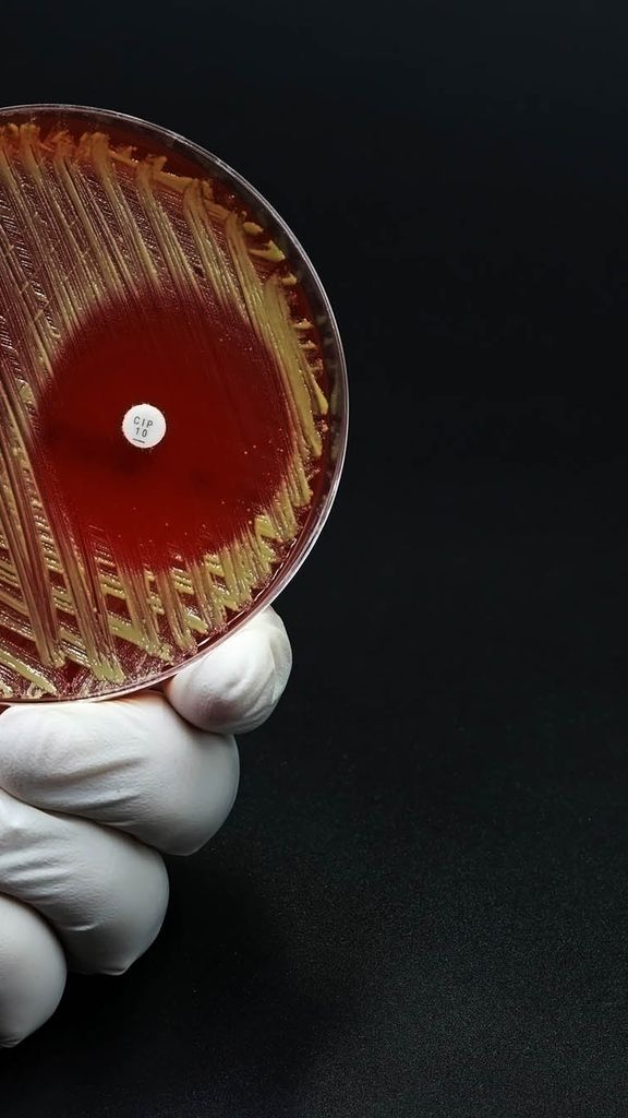 Photo: Stock of a white latex gloved hand holding a Petri dish with a microbiological culture Petri dish with bacteria where an antibiotic resistance test has been carried out.