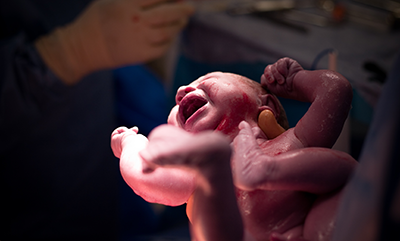 newborn-at-delivery