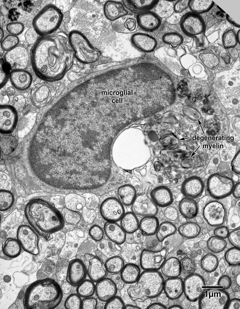 14_9_AM91Fornix#234text