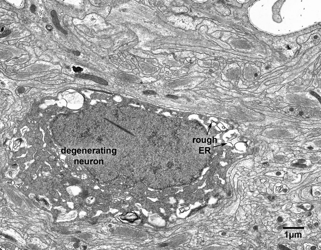 16_1_AM12a46L1#130text