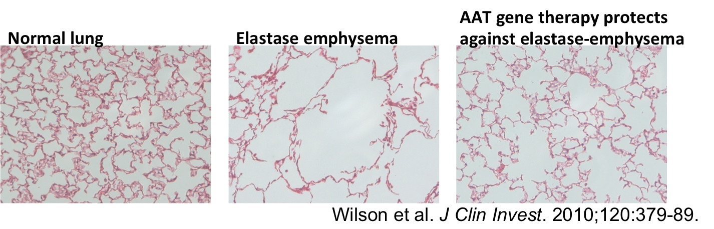 Elastase images for website