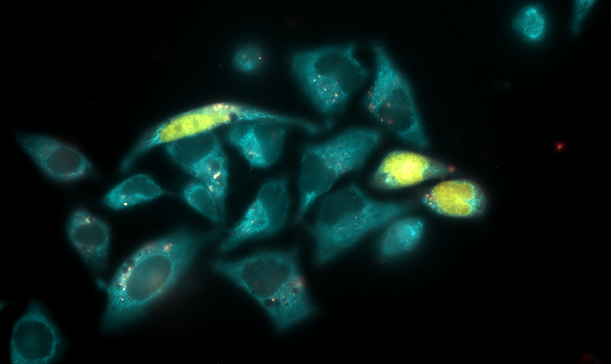 Illuminated microscopic image of cells
