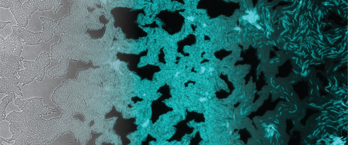 microscopic view of stained bacteria