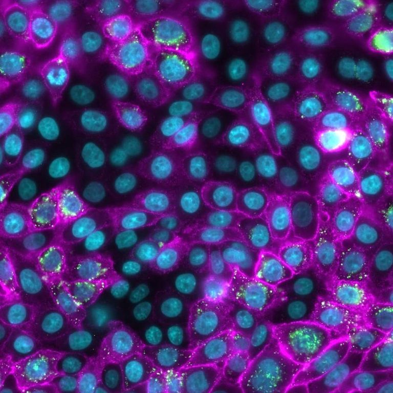 Illuminated microscopic image of cells