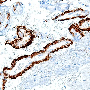 Amyloid Beta Protein