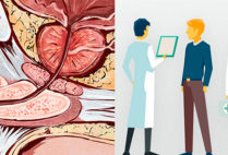 graphic showing the prostate gland and a prostate cancer care team