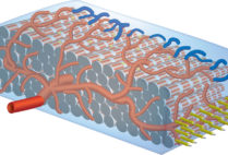 A cardiac patch.