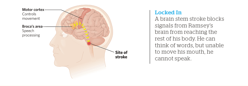 Locked In: A brain stem stroke blocks signals from Ramsey’s brain from reaching the rest of his body. He can think of words, but unable to move his mouth, he cannot speak.