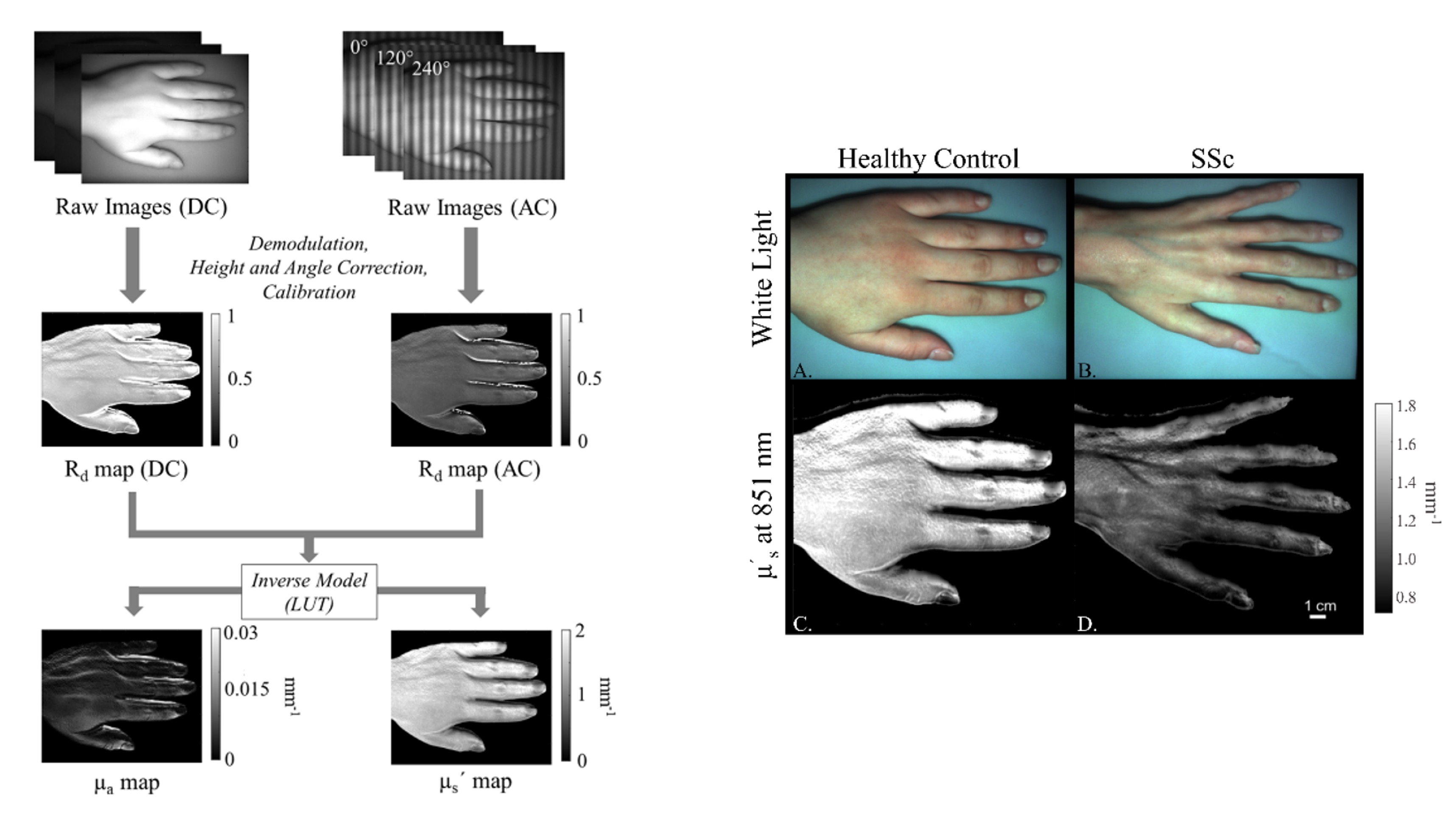Processing pipeline for SFDI measurements and comparison of healthy control and scleroderma patient