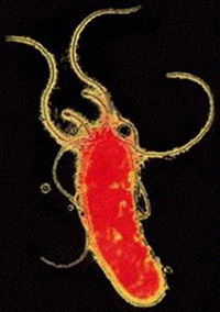 The ulcer-causing bacterium Helicobacter pylori. Image courtesy of LumeRx.  LumeRx 2004 