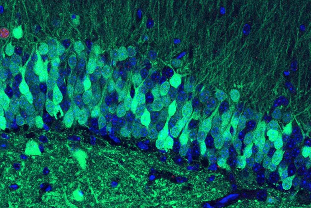 This is what a negative memory looks like in the mouse brain. The cells glowing green indicate they were active during the formation of that memory. Courtesy of Stephanie Grella and the Ramirez Group at Boston University