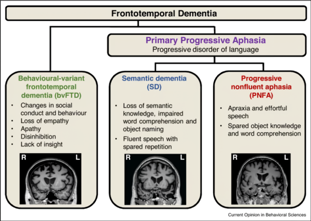 presentations of dementia