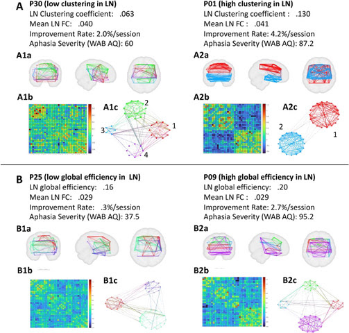 P30 (low clustering in LN), P01 (high clustering in LN), P25 (low global efficiency in LN), P09 (high global efficiency in LN)