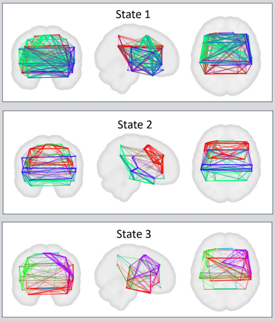 Brain imaging in State 1, State 2, State 3. Provided by isaac falconer.