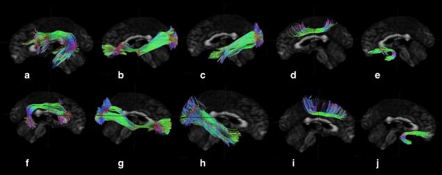 10 images of brain scans provided by Kateri Killela.