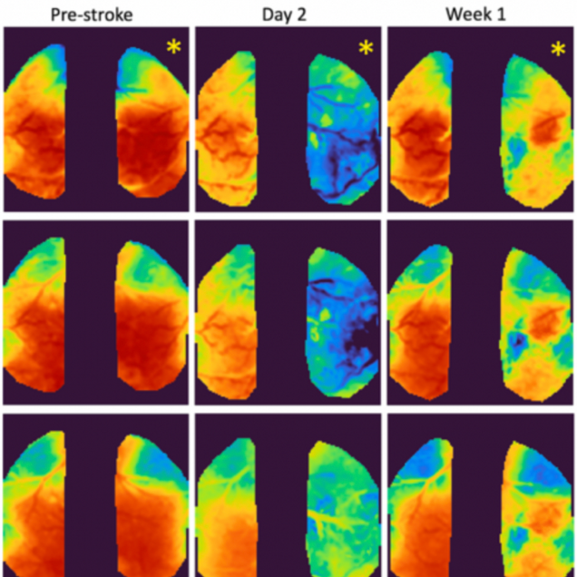 montage of brain scan images