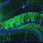 Stained microscopic image of Brain cross-section