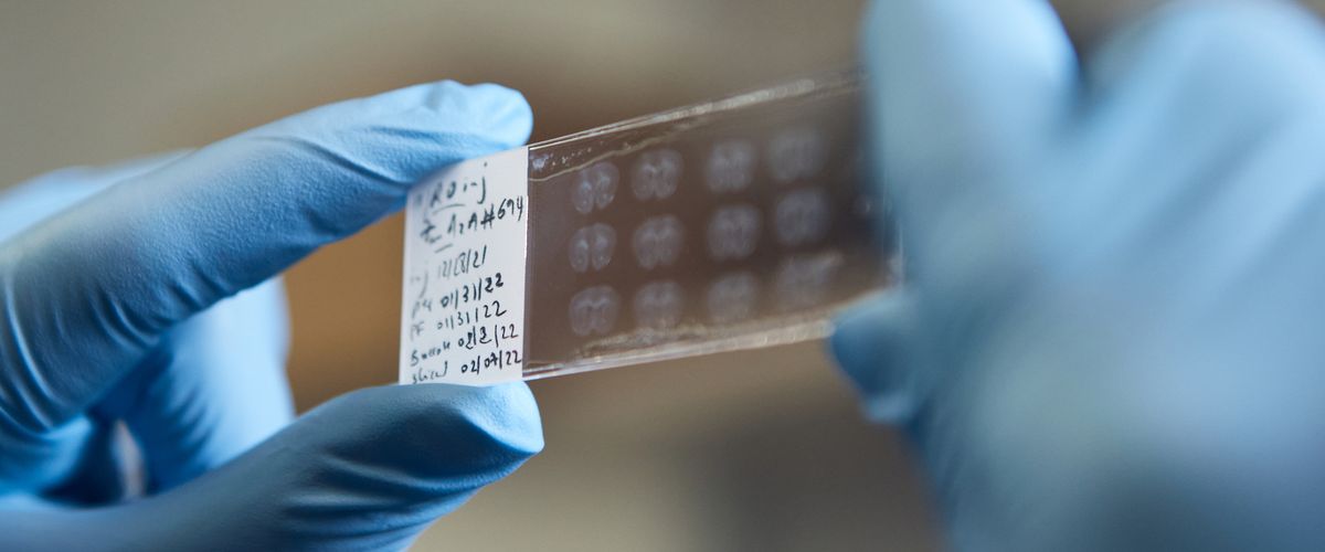 Gloved hands holding up a laboratory glass slide sample