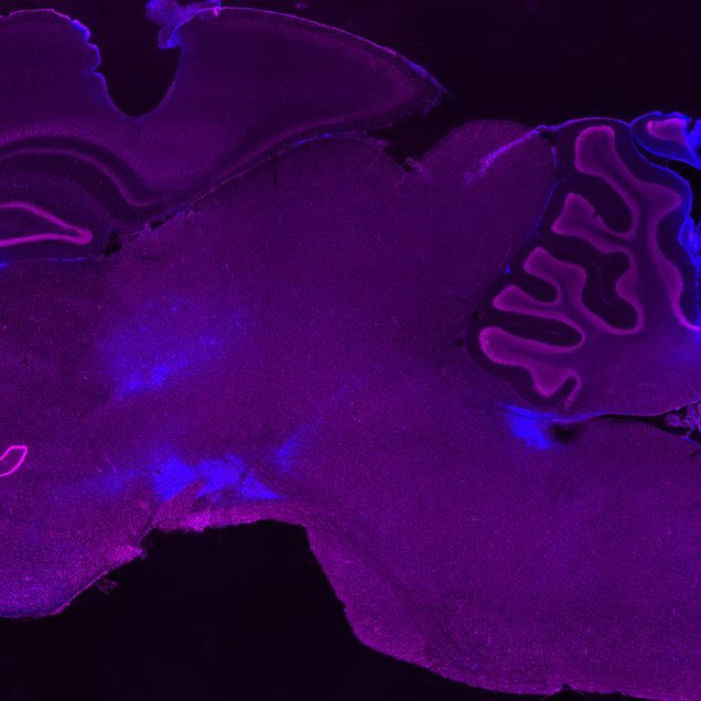 stained cross section of a brain