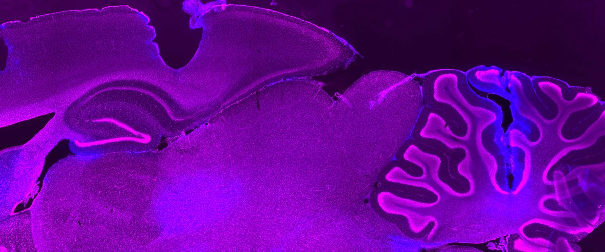 stained cross section of a brain