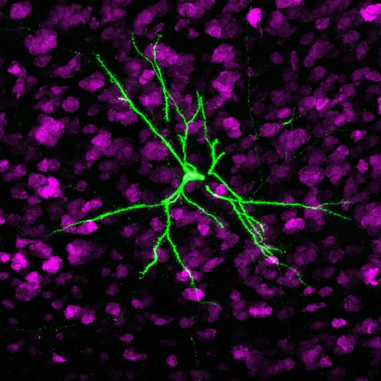 microscopic view of stained brain cells