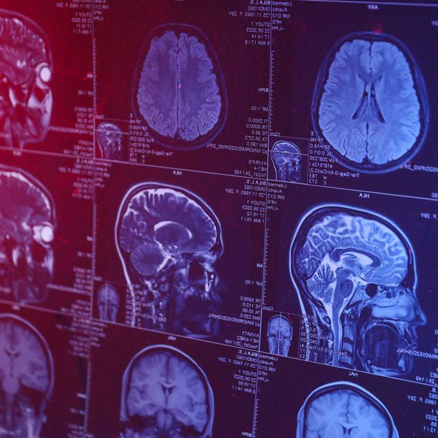 NinjaNIRS is a modular and portable functional near-infrared spectroscopy (fNIRS) device designed for high-density, whole-head brain activity monitoring. Photo by Bernhard Zimmermann