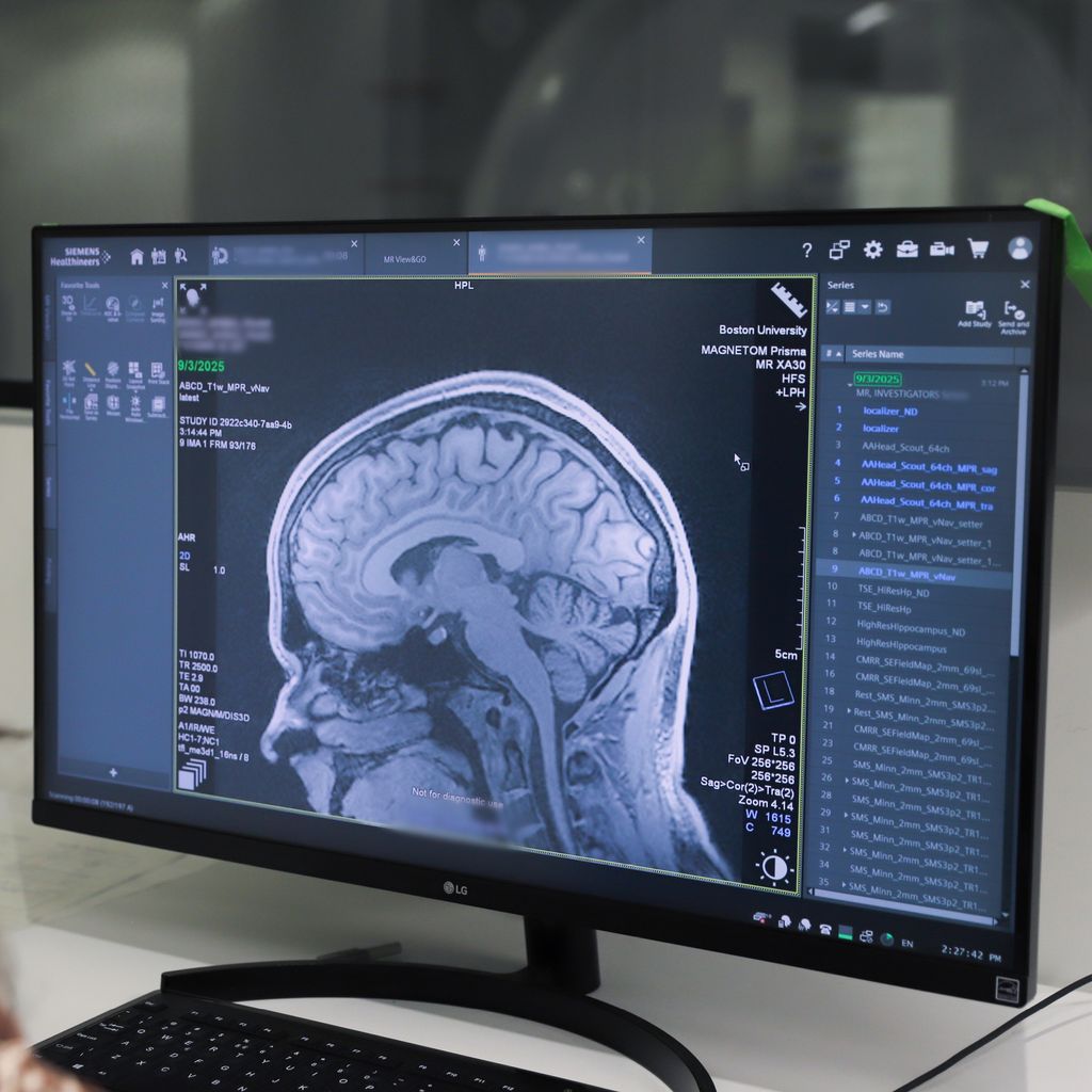 An MRI scan showing anatomical structures at the brain midline. Photo by Jack Osmond